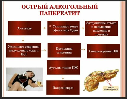 таблица симптомов панкреатита